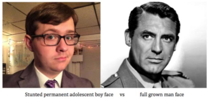 Did People In the Past Age Faster & Why?