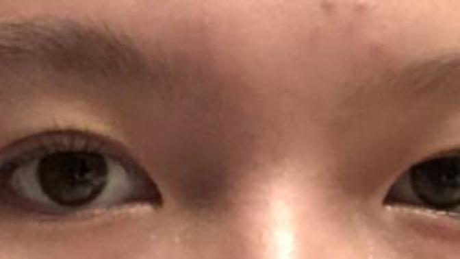 Would you date a girl with in-proportionate eyes like mine?