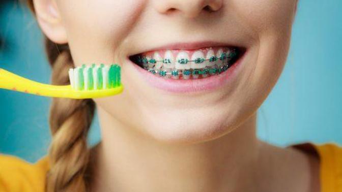 Did you ever have braces for your teeth?