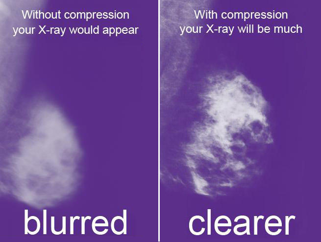 Girls, would you rather have a pleasant mammogram for a poor image (50%), uncomfortable one for a great image (93%), or a painful one for the best?