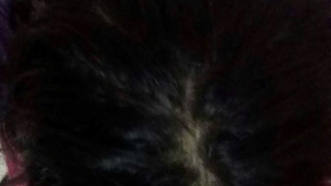 Is this a bald patch?