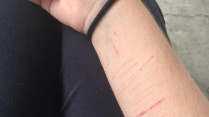 Why do girls cut themselves?