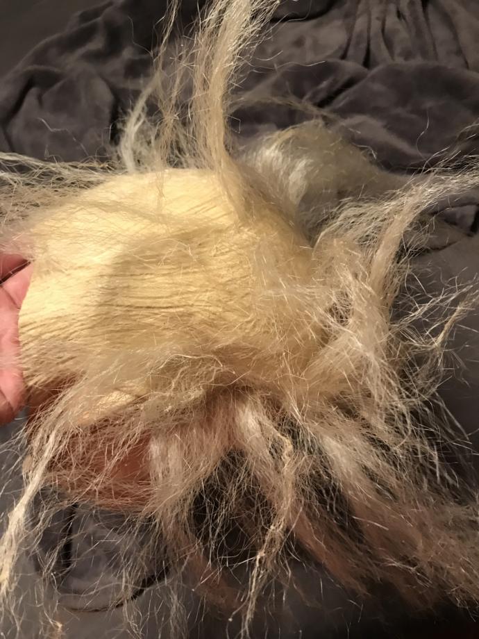 You can kinda see it here but it’s all over the scalp