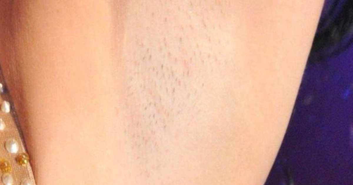 Girls, how does Katy Perry�s armpit hair look? GirlsAskGuys Girls, how does Katy Perry�s armpit hair look? GirlsAskGuys