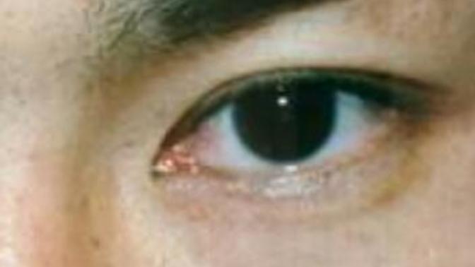 Single eyelid or double eyelid which is attractive?