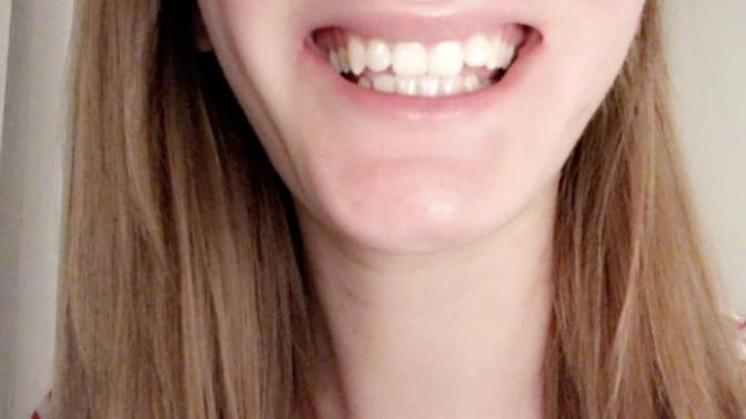 As you can see, my teeth look very bad - Should I get them done?