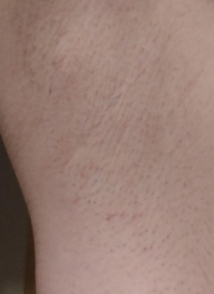 Girls, do I have stubble after shaving?
