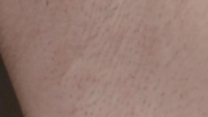 Girls, do I have stubble after shaving?