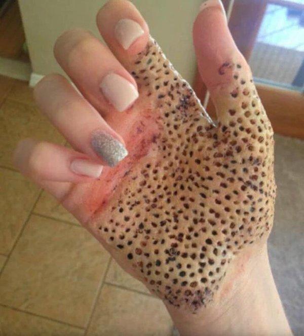 Who here has trypophobia? (Fear of clusters/patterns of holes) google it if you want?
