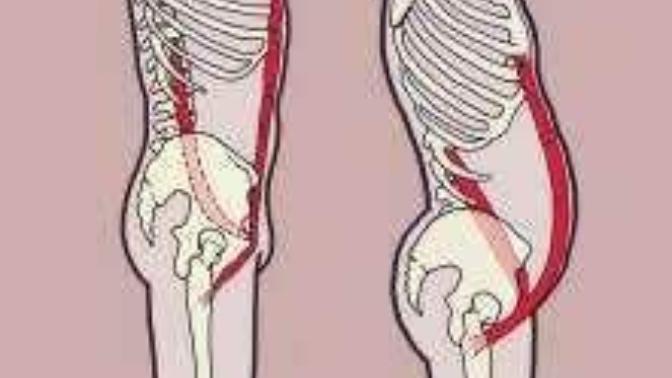 Is it possible that a person be skinny yet have a protruding belly?