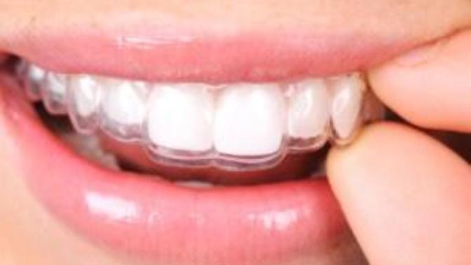 My Invisalign braces cracked! What should I do?