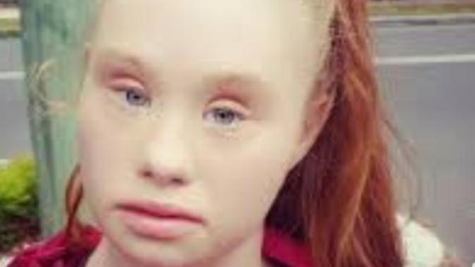 Would you date someone with down syndrome?
