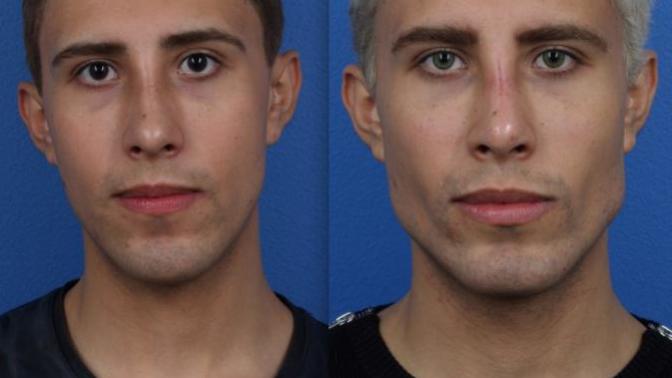 Would you get plastic surgery?