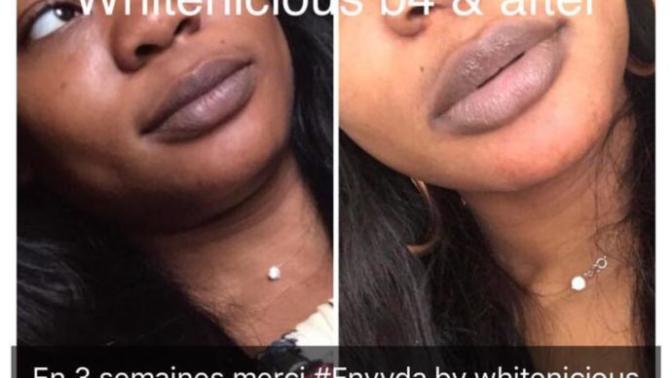 How do you feel about whitening creams in black culture?