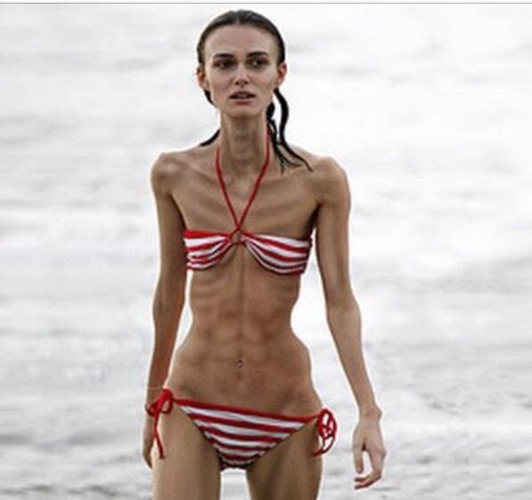 Is Body Positivity Just An Excuse for People to Be Lazy and Unhealthy?