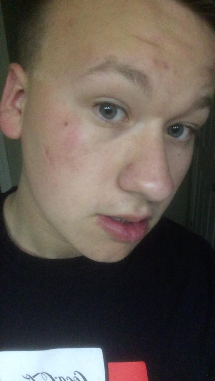 Girls are scars attractive?