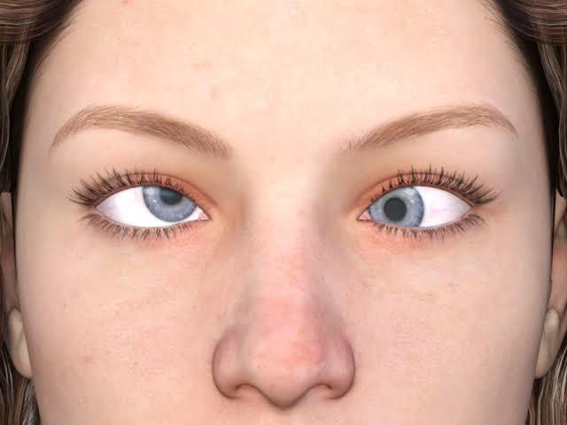 If a girl has cross eyes would it turn you off?