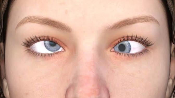 If a girl has cross eyes would it turn you off?