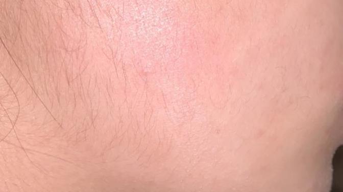 Is it normal if a female has this hair on side of face? is this okay or unattractive?