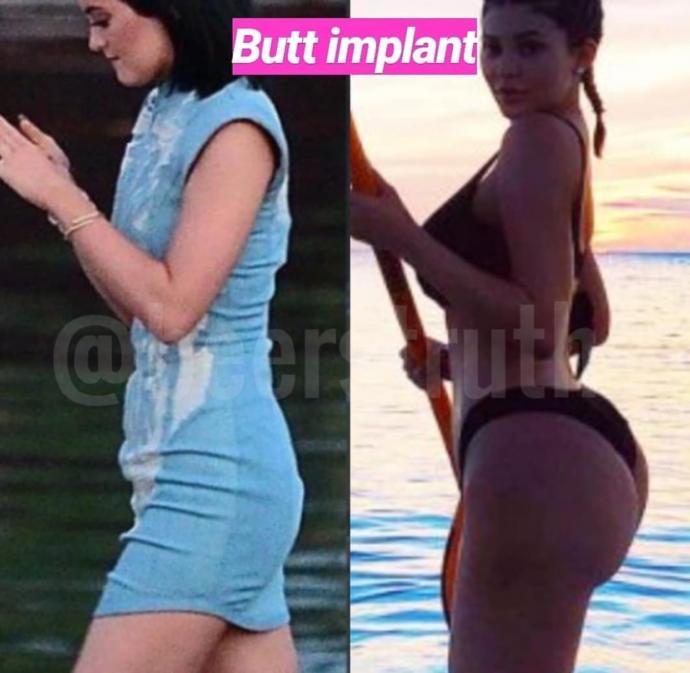 Why do people drool over Kylie Jenner?