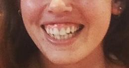 Would this smile seduce you if a girl smiled like this at you while flirting?
