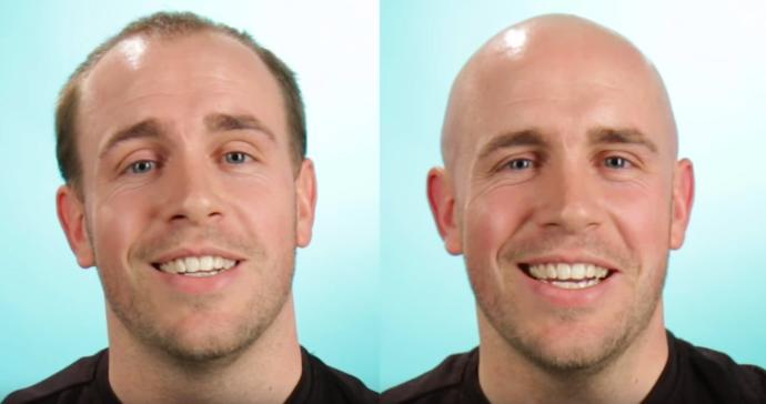 Do these guys look better bald?