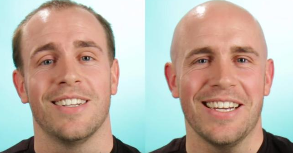 Do these guys look better bald? GirlsAskGuys