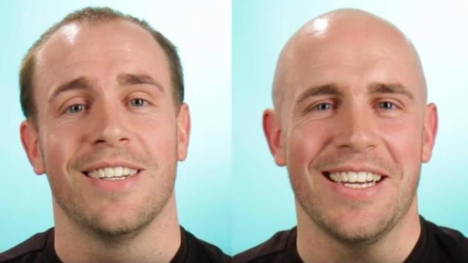 Do these guys look better bald?