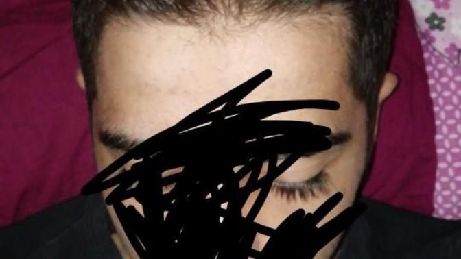 Is this considered as balding?