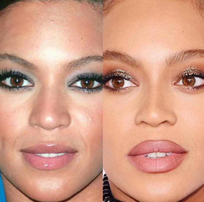 Is this rhinoplasty or just makeup?