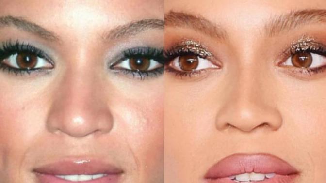 Is this rhinoplasty or just makeup?