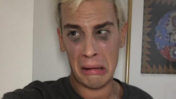 Milo Yiannopoulos needs help! Will any of you guys come to his rescue?
