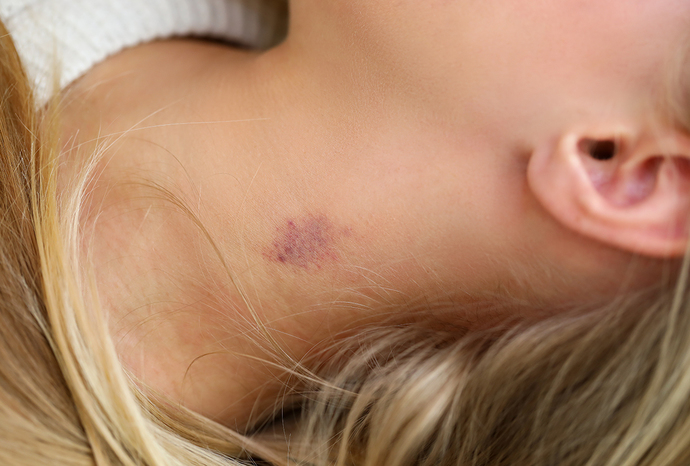 Why do you give hickeys?
