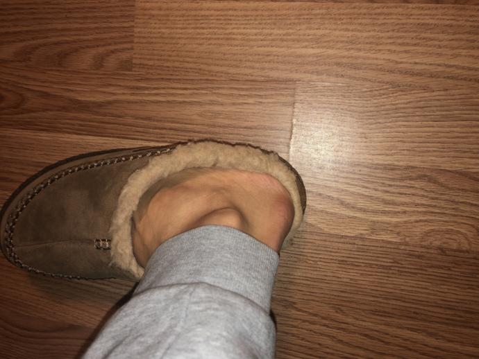 Wearing Winter Slippers Outdoors?