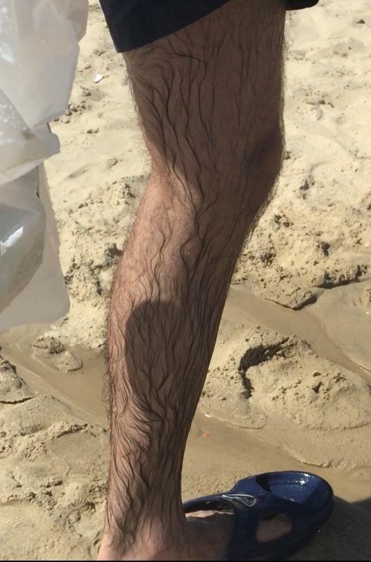 Why do most people discourage men for having smooth legs?