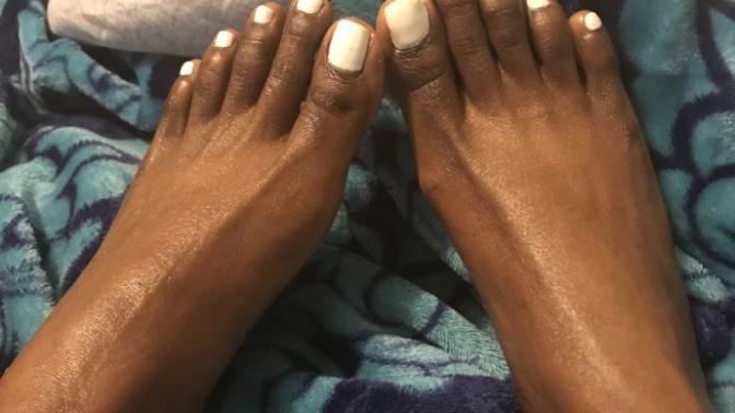 Would you call these feet ugly?