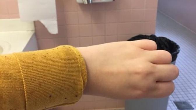 Would You Hold This Hand?