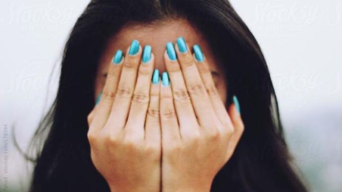 Does acne make someone unattractive?