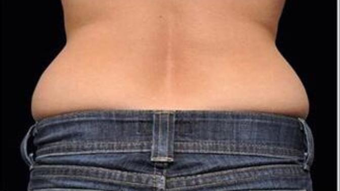 How do you get rid of love handles/lower back fat?
