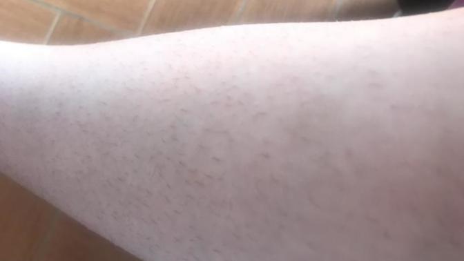 What can you do when your hair are too long to be unseen and too short to be waxed?