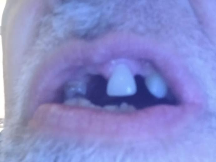 Are missing teeth a dealbreaker for you?