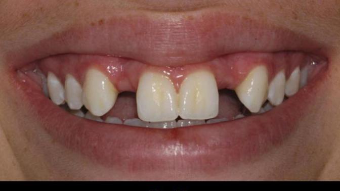 Are missing teeth a dealbreaker for you?