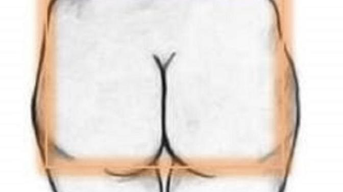 My butt looks similar to this, can I still wear a bodycon dress?