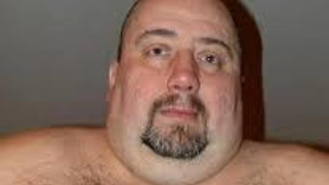 Should men with manboobs wear bikini top to avoid double standard?