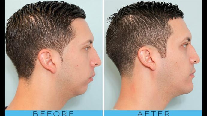 How important is it to you that a guy has a good jawline?