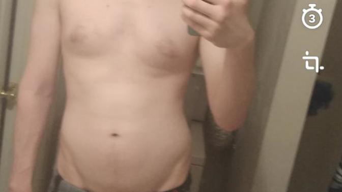 Man boobs won't go away?