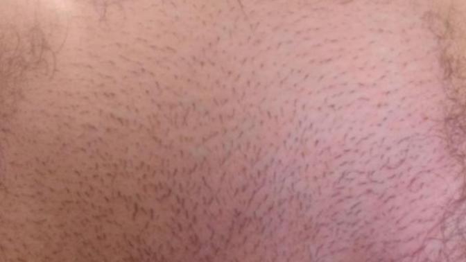 Girls, does my bottom look bad or not (although I've shaved)?