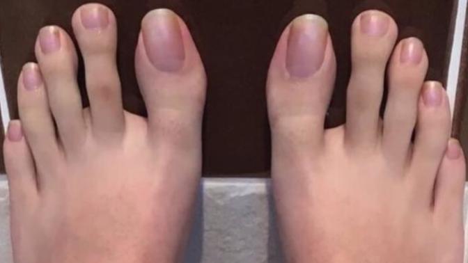 Girls, are long toes considered a turnoff in your boyfriend?