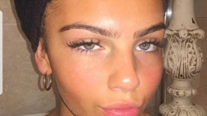 Would you date somone with a lazy eye?