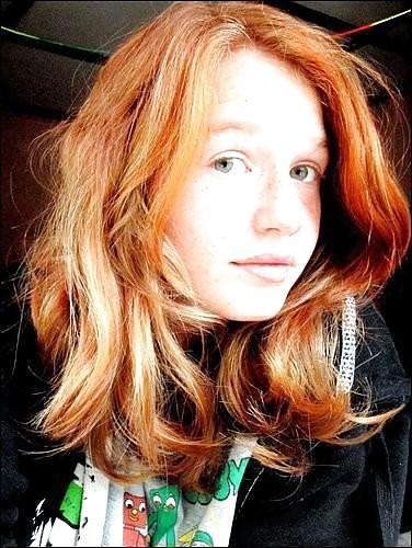 Guys would you date a redhead girl like me that has epilepsy?